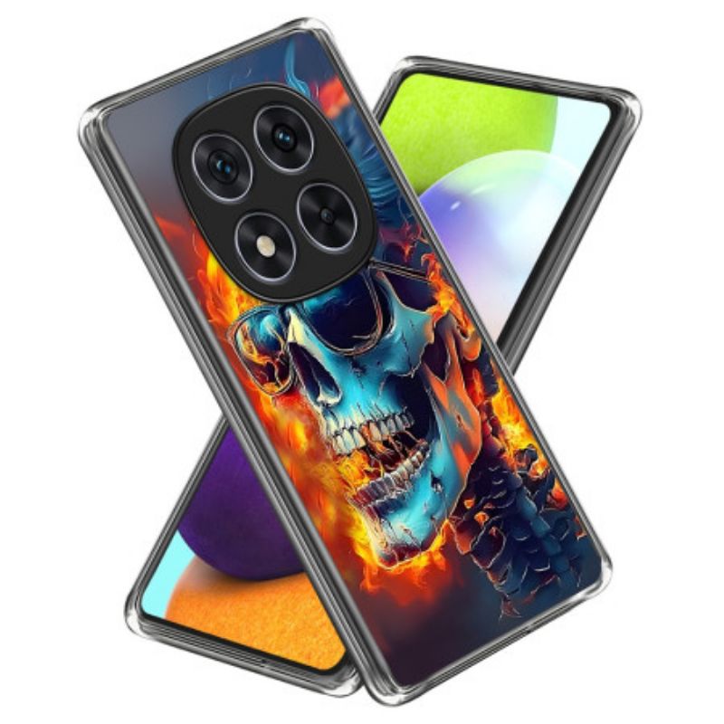 Cover Til Xiaomi Redmi Note 14 Pro 4g Flammende Kranium