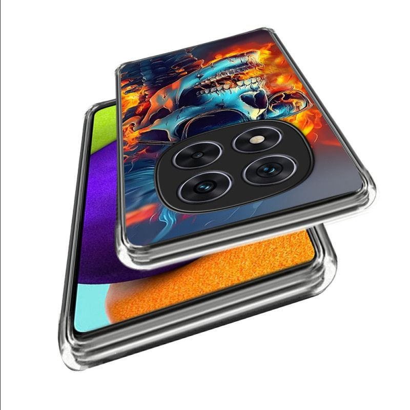 Cover Til Xiaomi Redmi Note 14 Pro 4g Flammende Kranium